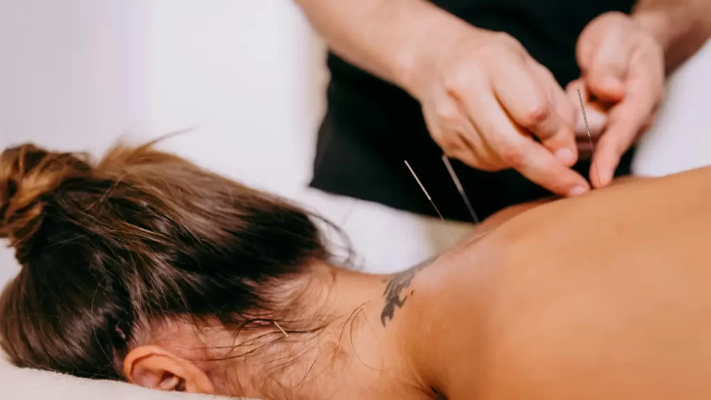 acupuntura
